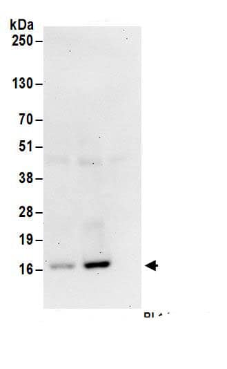 RPS19 Antibody