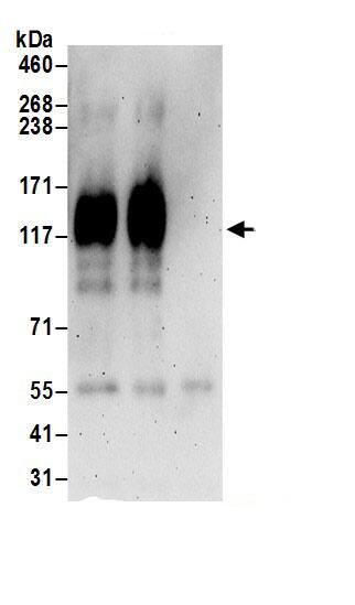 KCC4/SLC12A7 Antibody