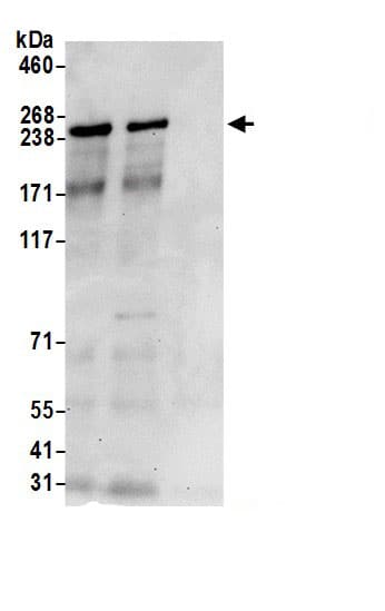 Tight Junction Protein 1 Antibody