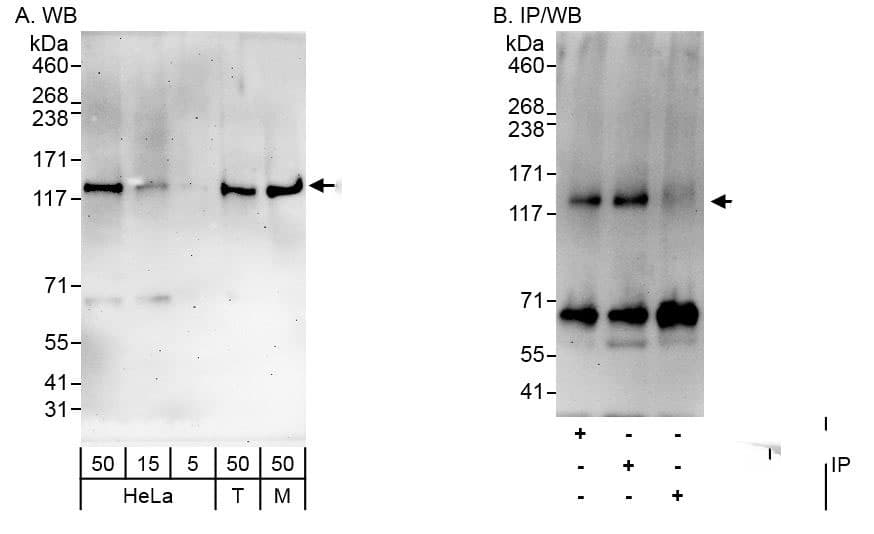 ARHGAP11A Antibody