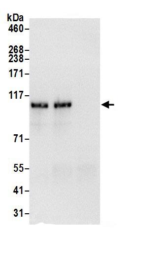 HIP1 Antibody