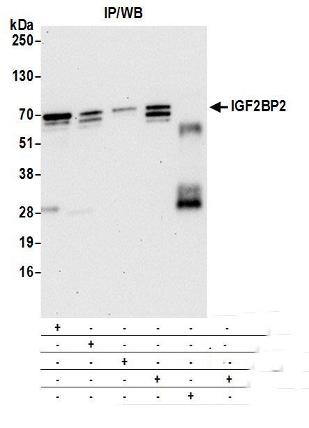 IMP2/IGF2BP2 Antibody (3A3.5F1)