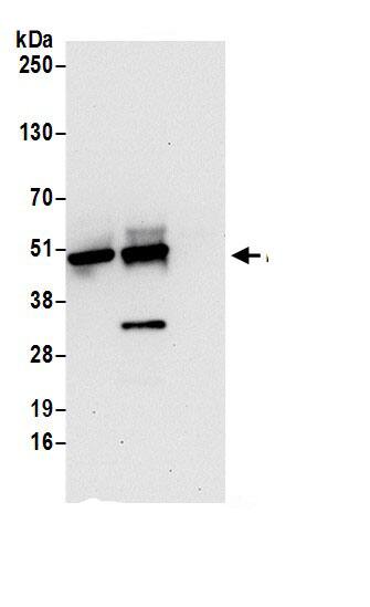 NUDCD3 Antibody