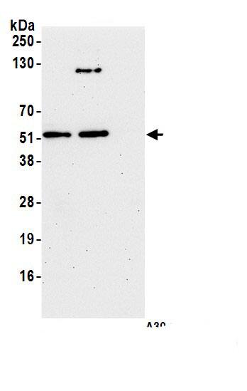 UFM1 Activating Enzyme/UBA5 Antibody