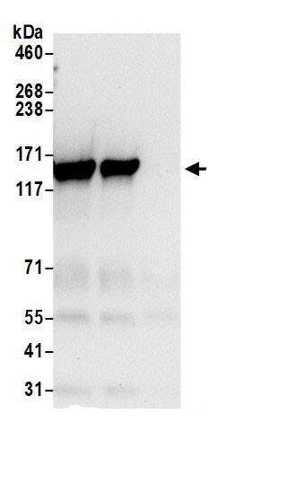 Tripeptidyl peptidase II Antibody