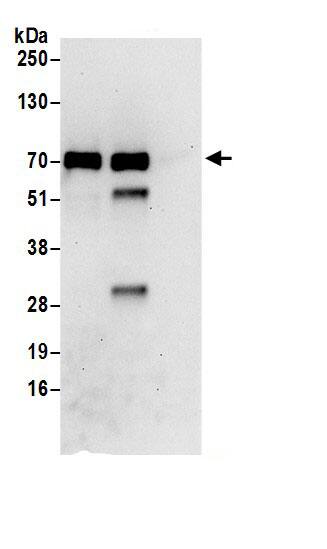 CTP synthase Antibody