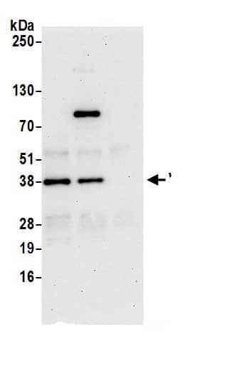 WIPF1/WIP Antibody