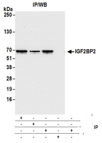 IMP2/IGF2BP2 Antibody (1E3.01E5)