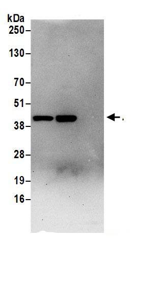 Aldolase A Antibody