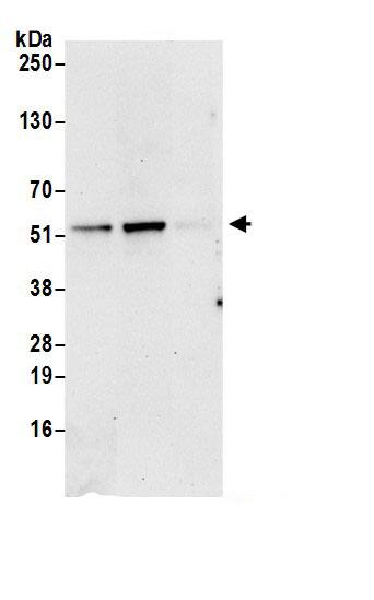 Proteasome 26S S5 Antibody