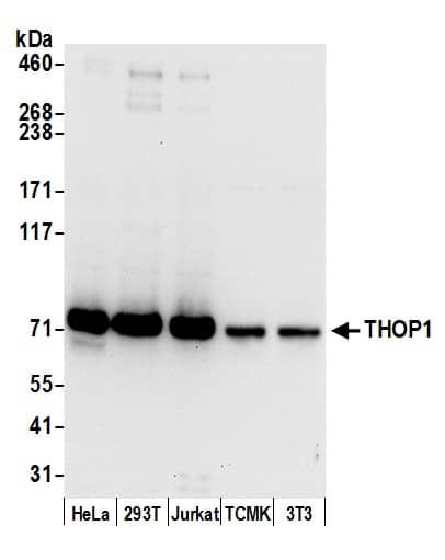 Thimet Oligopeptidase/THOP1 Antibody