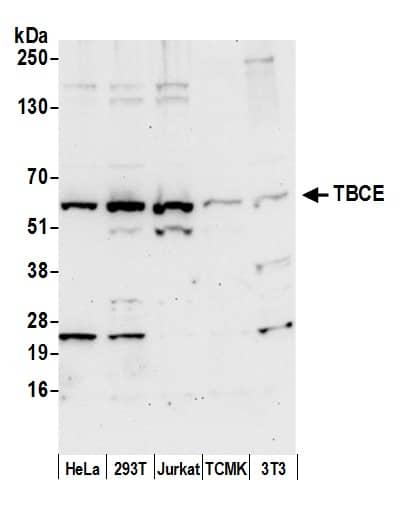 TBCE Antibody