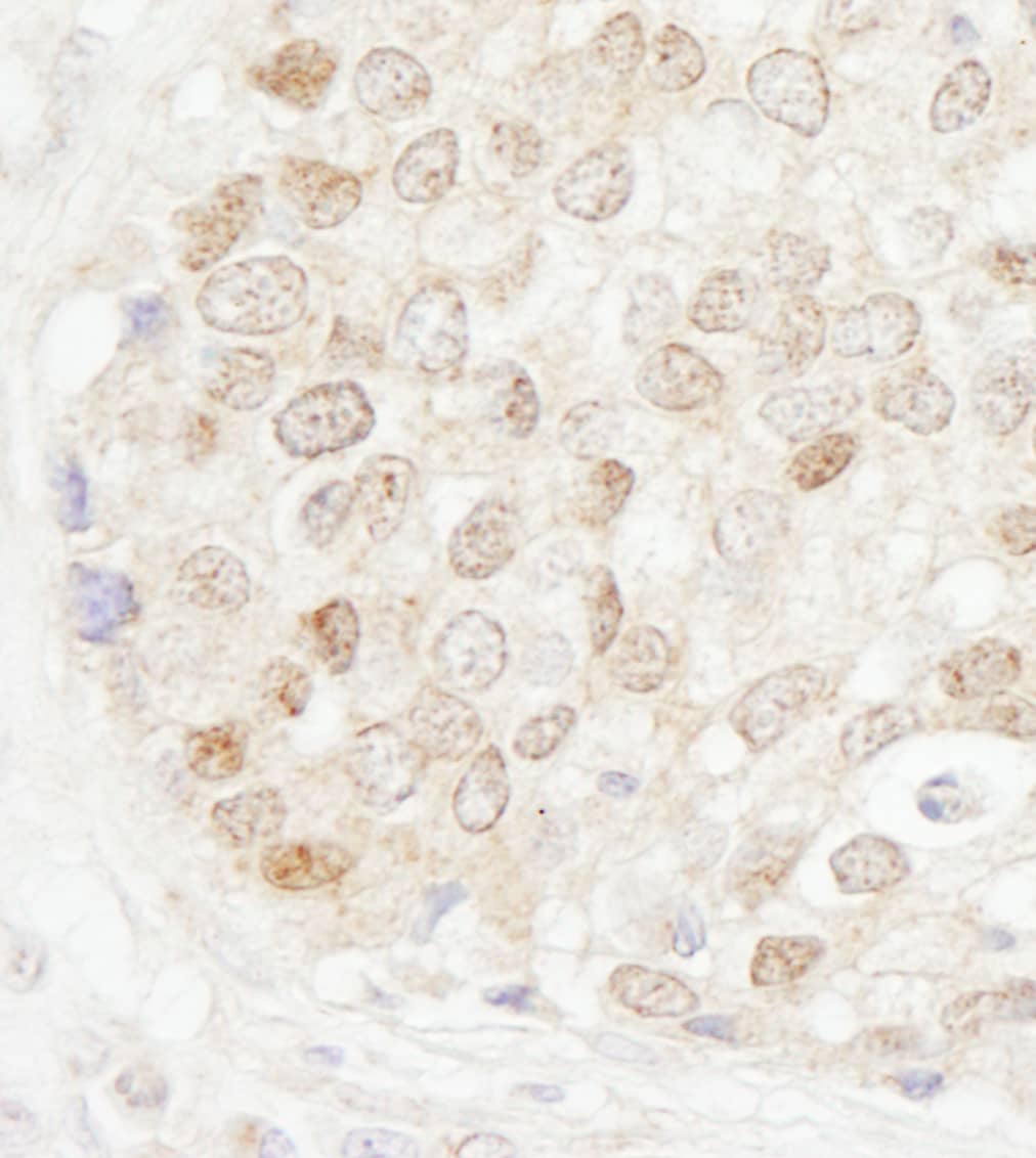 MBD4 Antibody