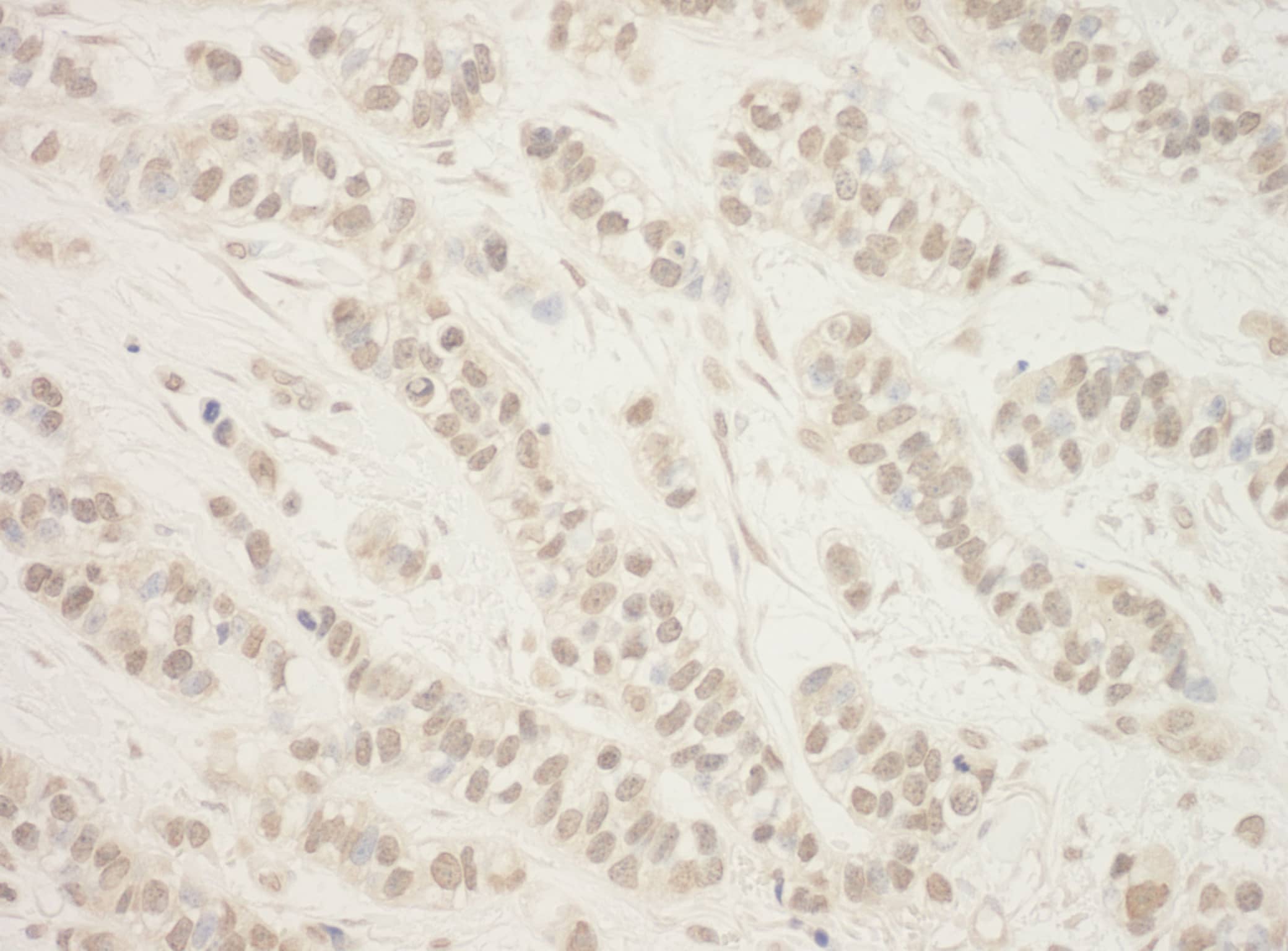 Folliculin Antibody