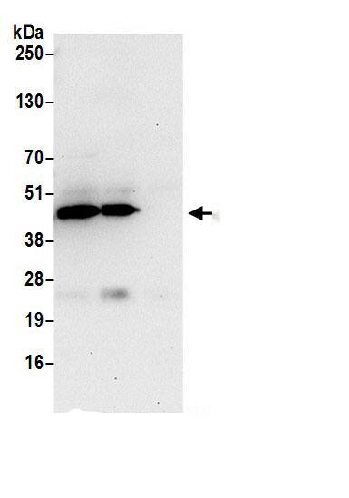 PPME1 Antibody