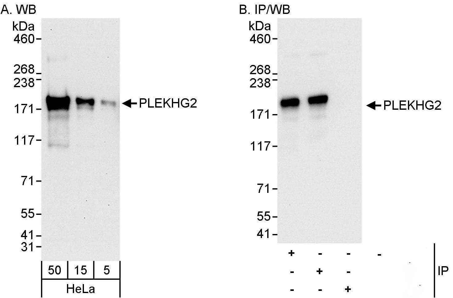 PLEKHG2 Antibody