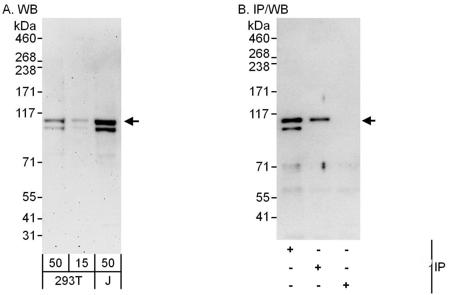 CHD1L Antibody