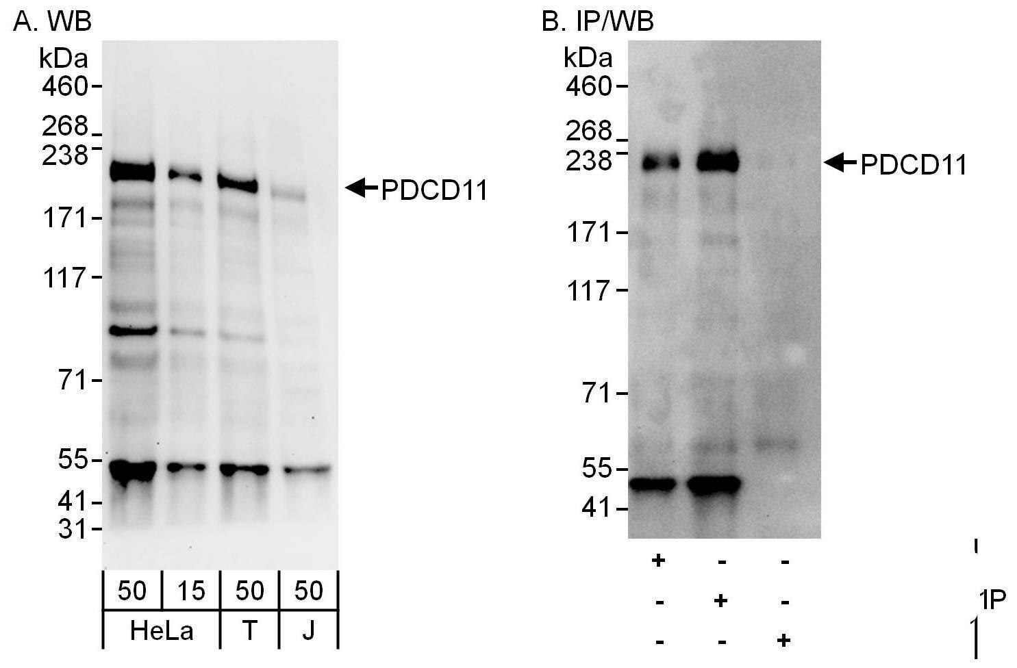 PDCD11 Antibody
