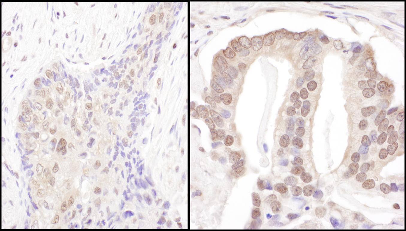 Proteasome 19S S3 Antibody