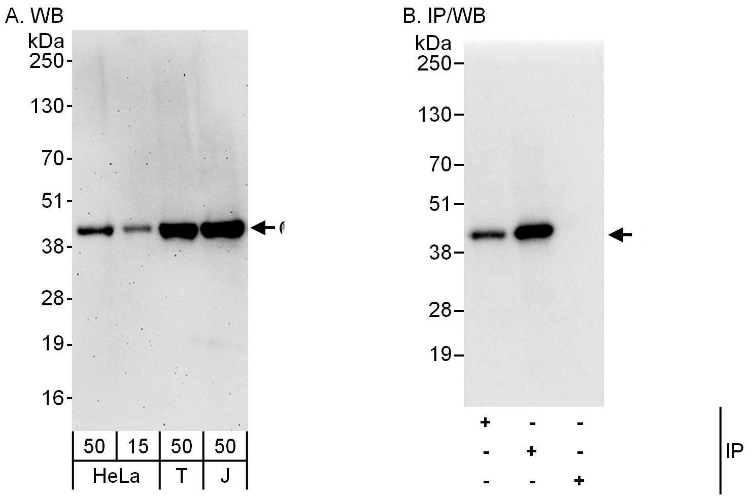 LASS2 Antibody