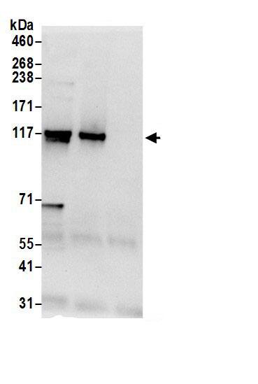 HIP1 Related Antibody