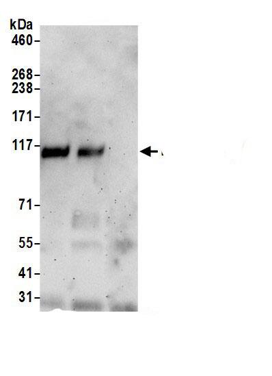 RAI14 Antibody