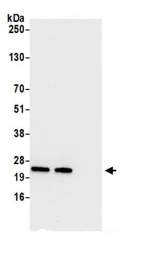 Biliverdin Reductase B/BLVRB Antibody