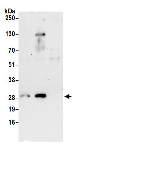 RPS8 Antibody