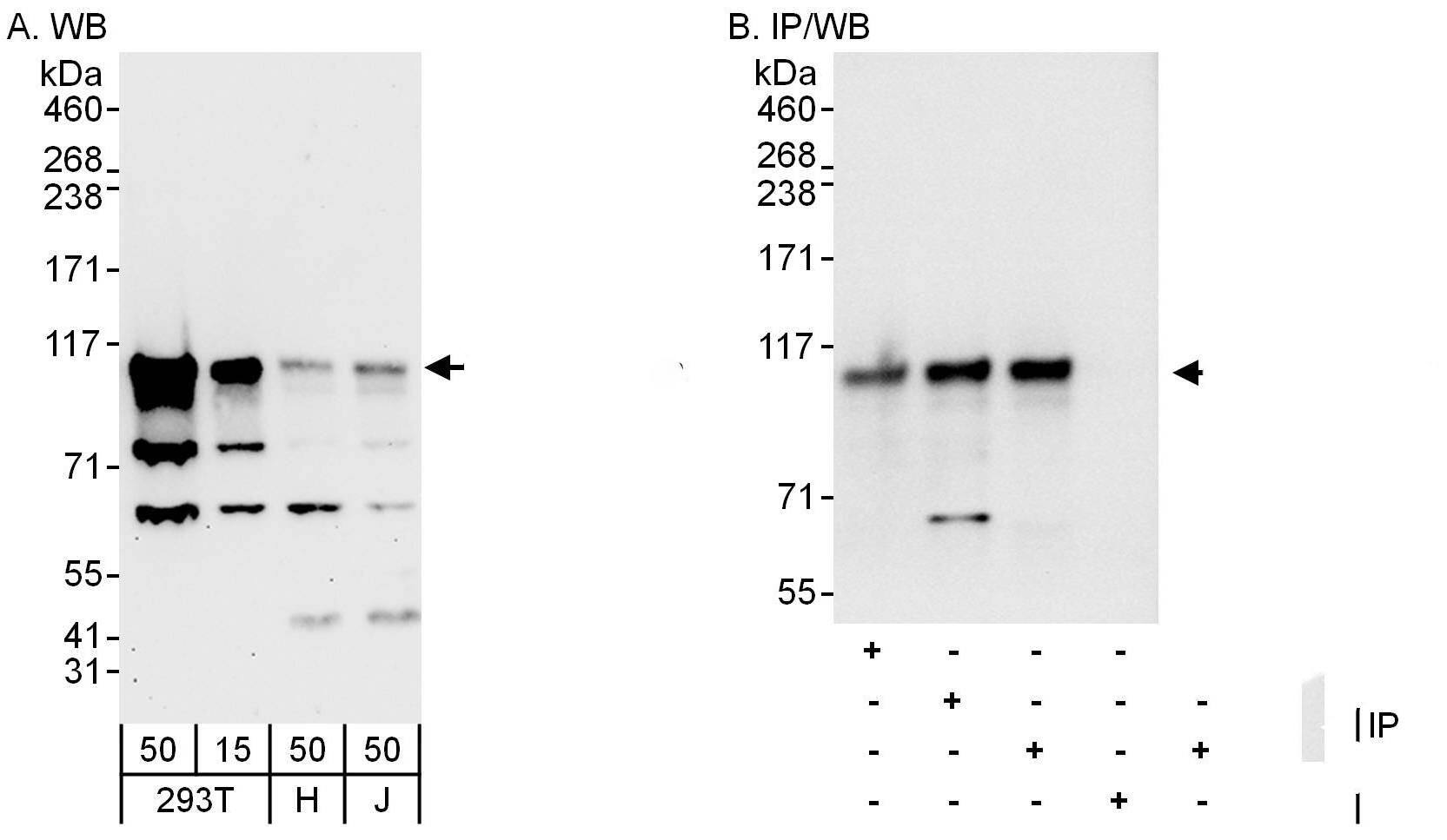 beta Adducin Antibody