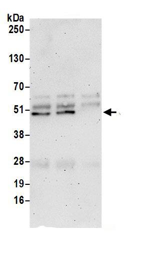 CD2BP2 Antibody