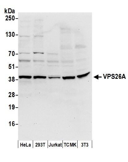 VPS26A Antibody