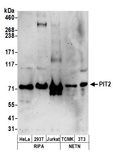 SLC20A2 Antibody