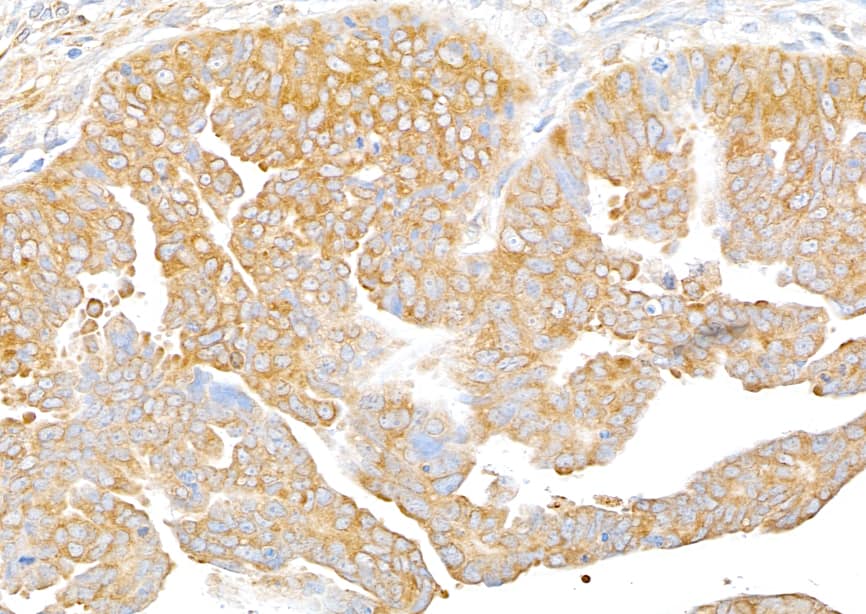 RPS3 Antibody