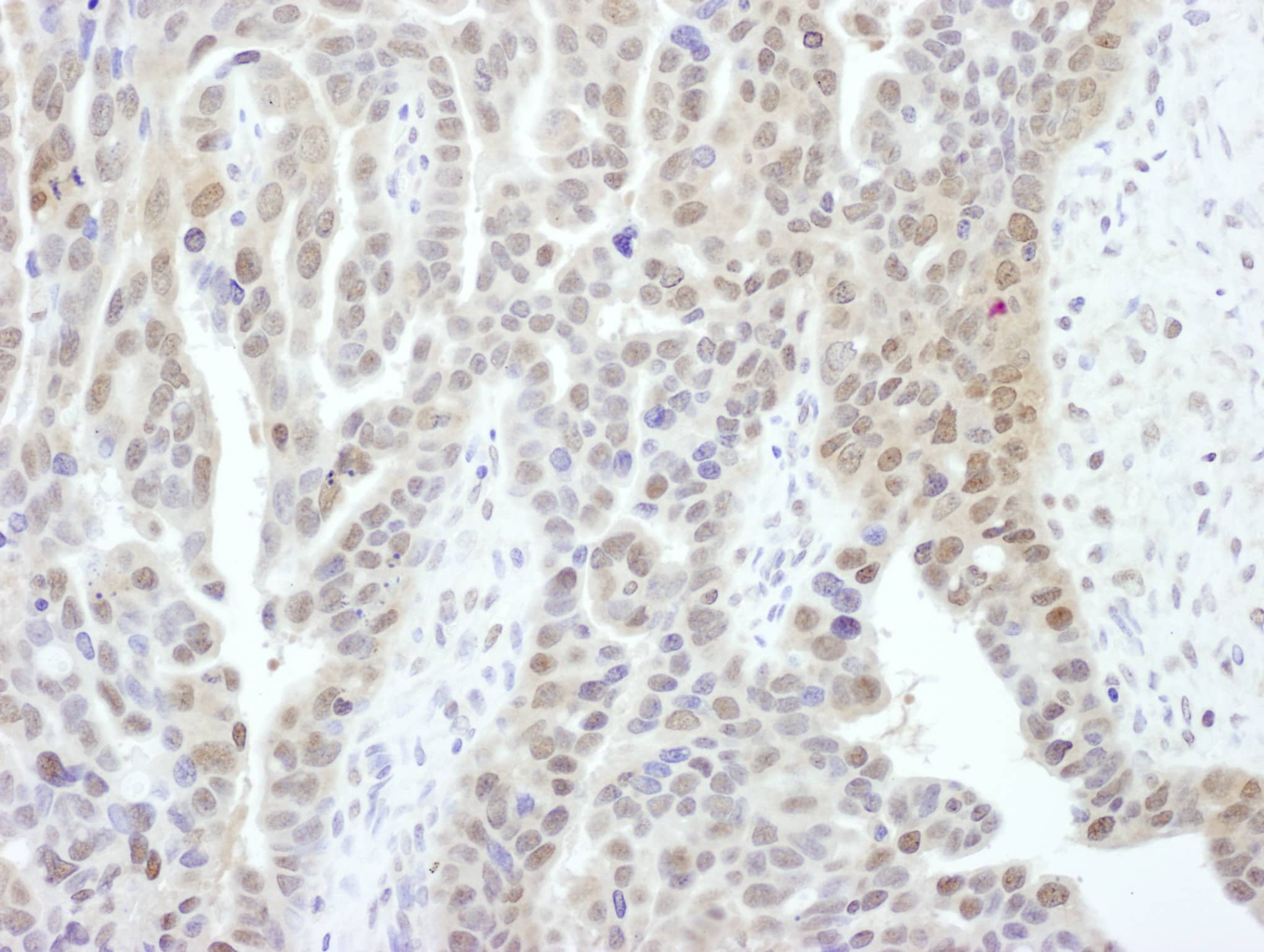 Rpn2 Antibody