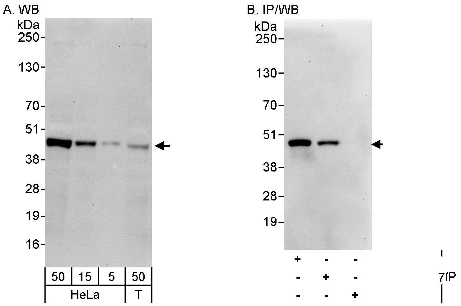 CAMKID Antibody