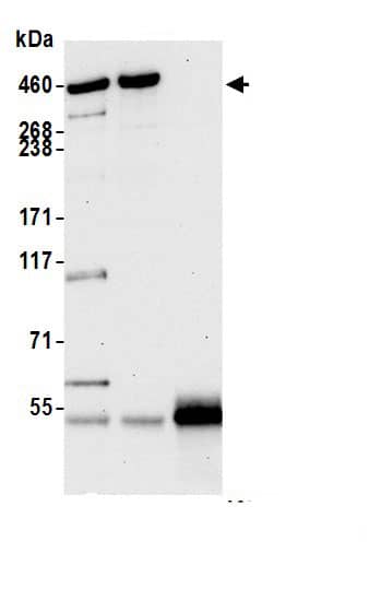 BRCA2 Antibody