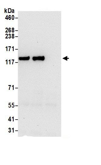 ZFR Antibody