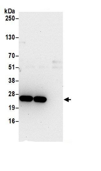 DTD1 Antibody