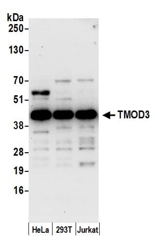 Tropomodulin 3 Antibody