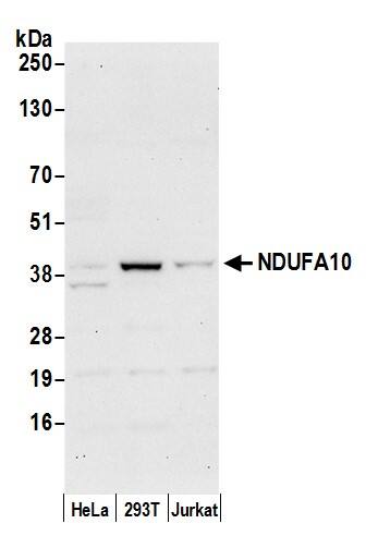 NDUFA10 Antibody