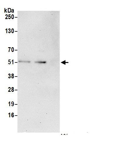 CEP44 Antibody