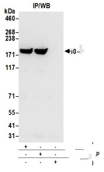 Clathrin Heavy Chain 1/CHC17 Antibody