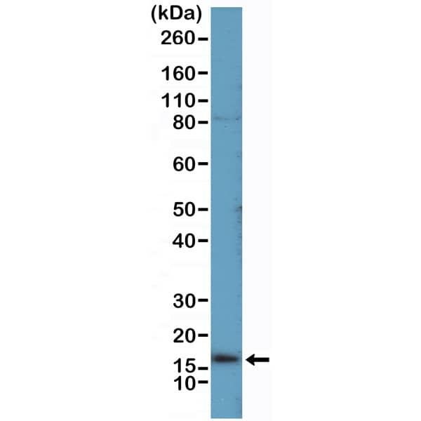 Uroplakin II Antibody (RM507)