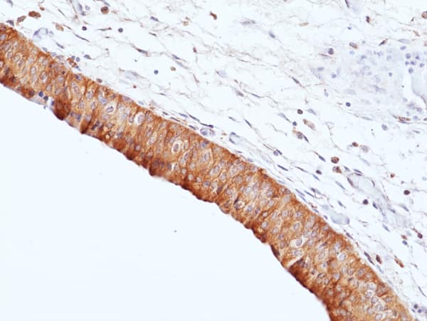 Uroplakin II Antibody (RM507)