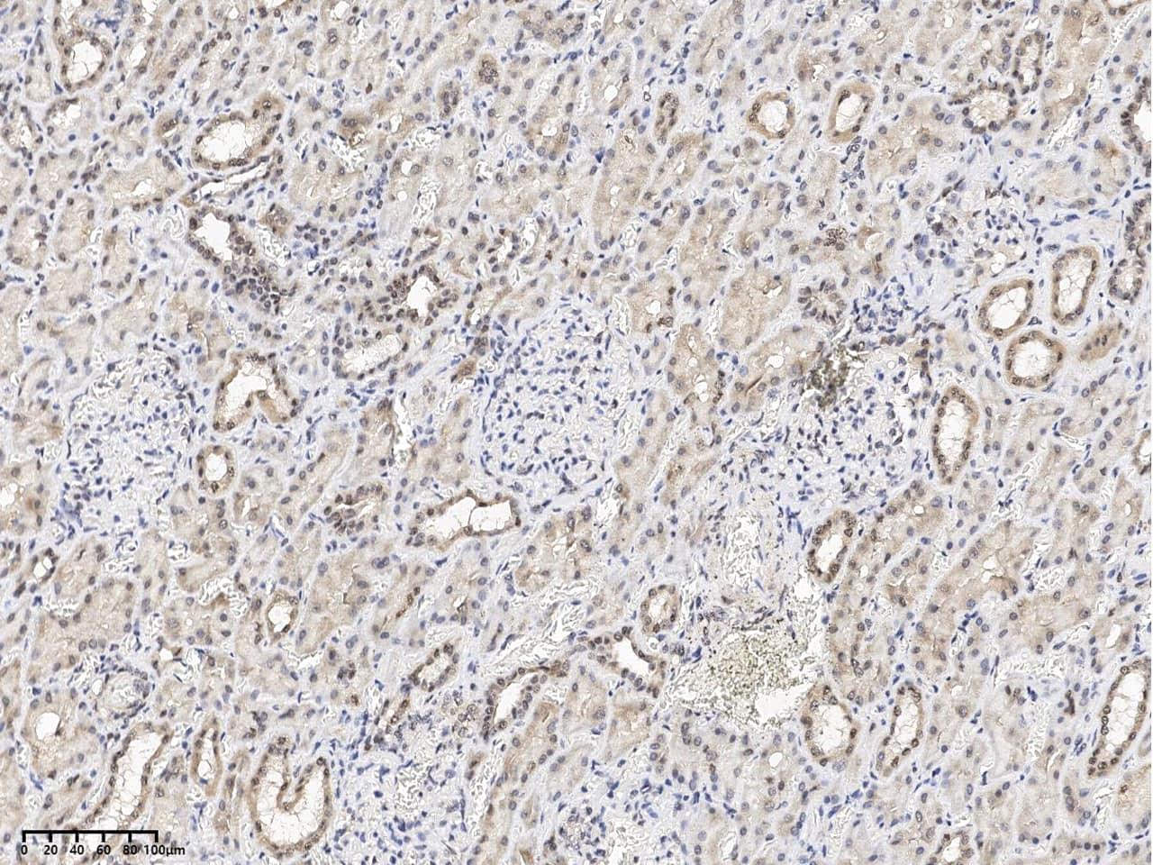 FDX1L Antibody