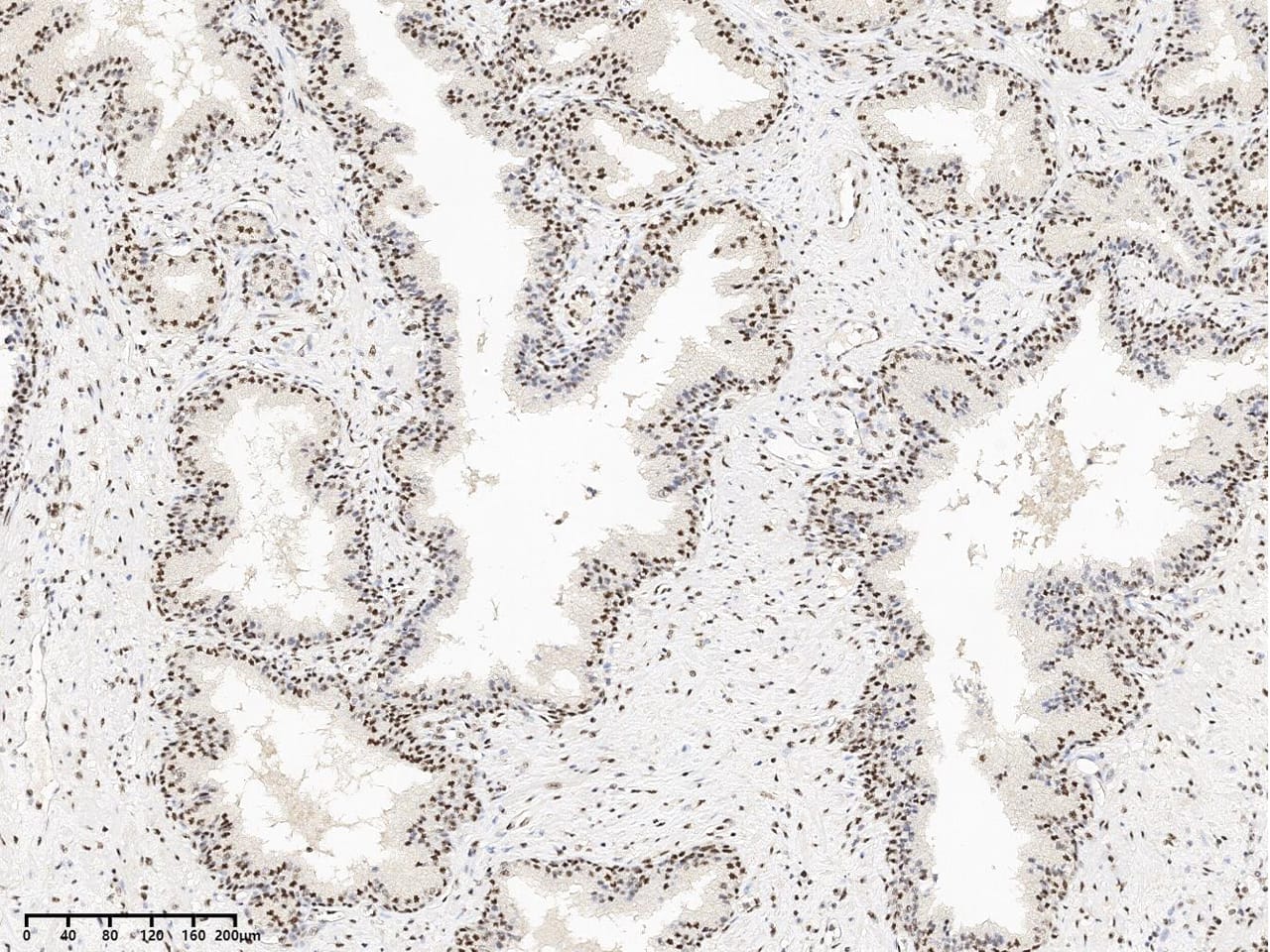 SON Antibody - BSA Free