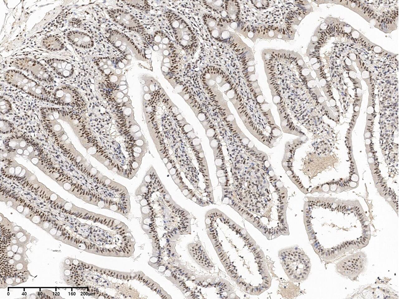 SON Antibody - BSA Free