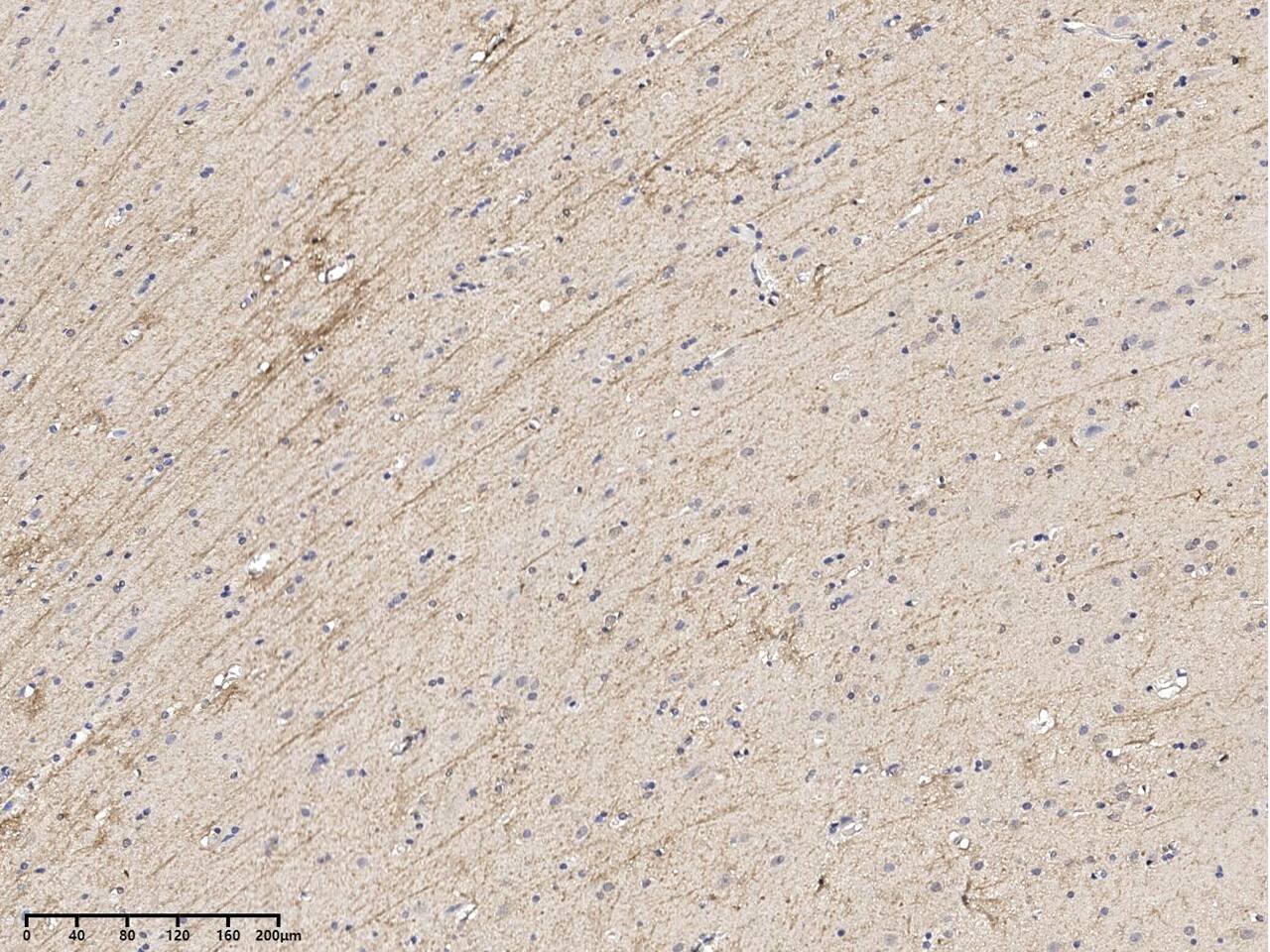 dystrophia myotonica containing WD repeat motif Antibody - BSA Free