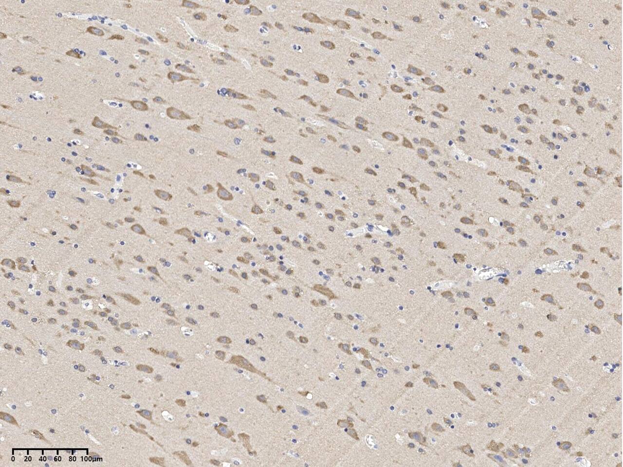 MAST1 Antibody - BSA Free