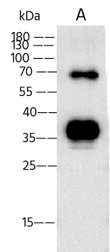 Monkeypox Virus E8L Antibody (15) - Azide and BSA Free